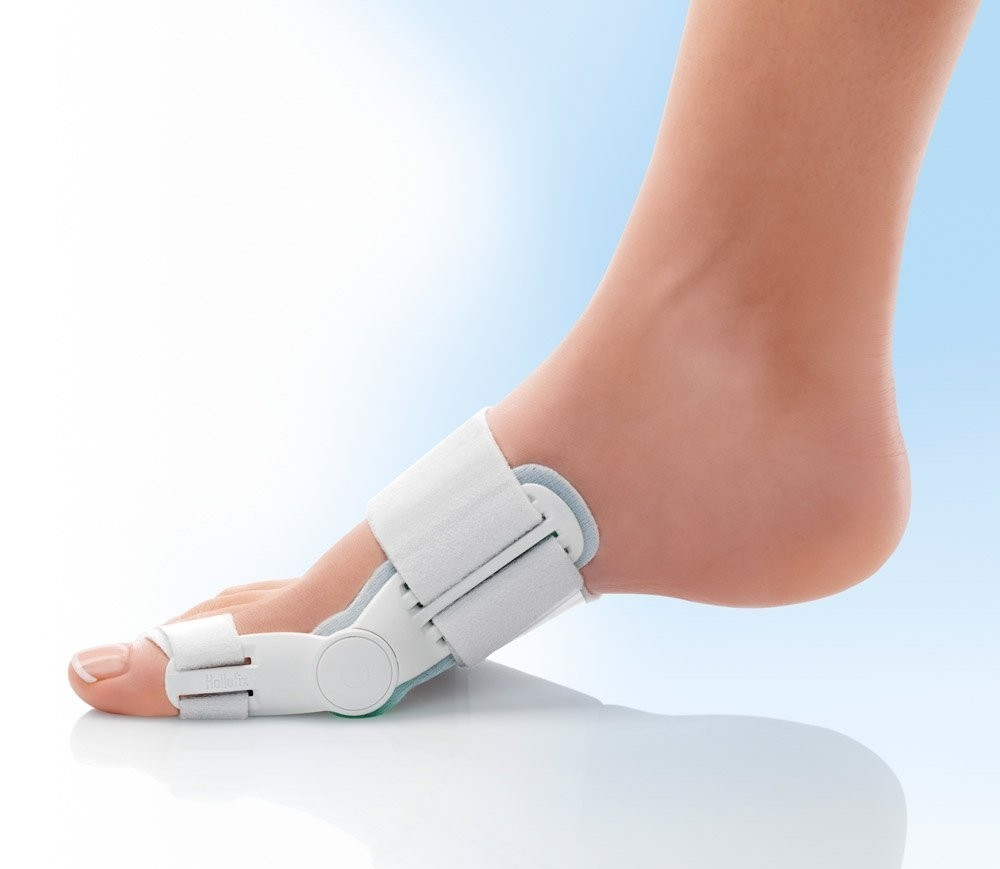 tutore per alluce valgo padova