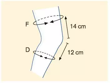 GINOCCHIERA GENU SENSA 50K15   
