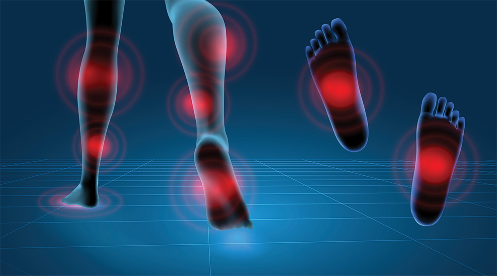 Gait analysis Vimedical