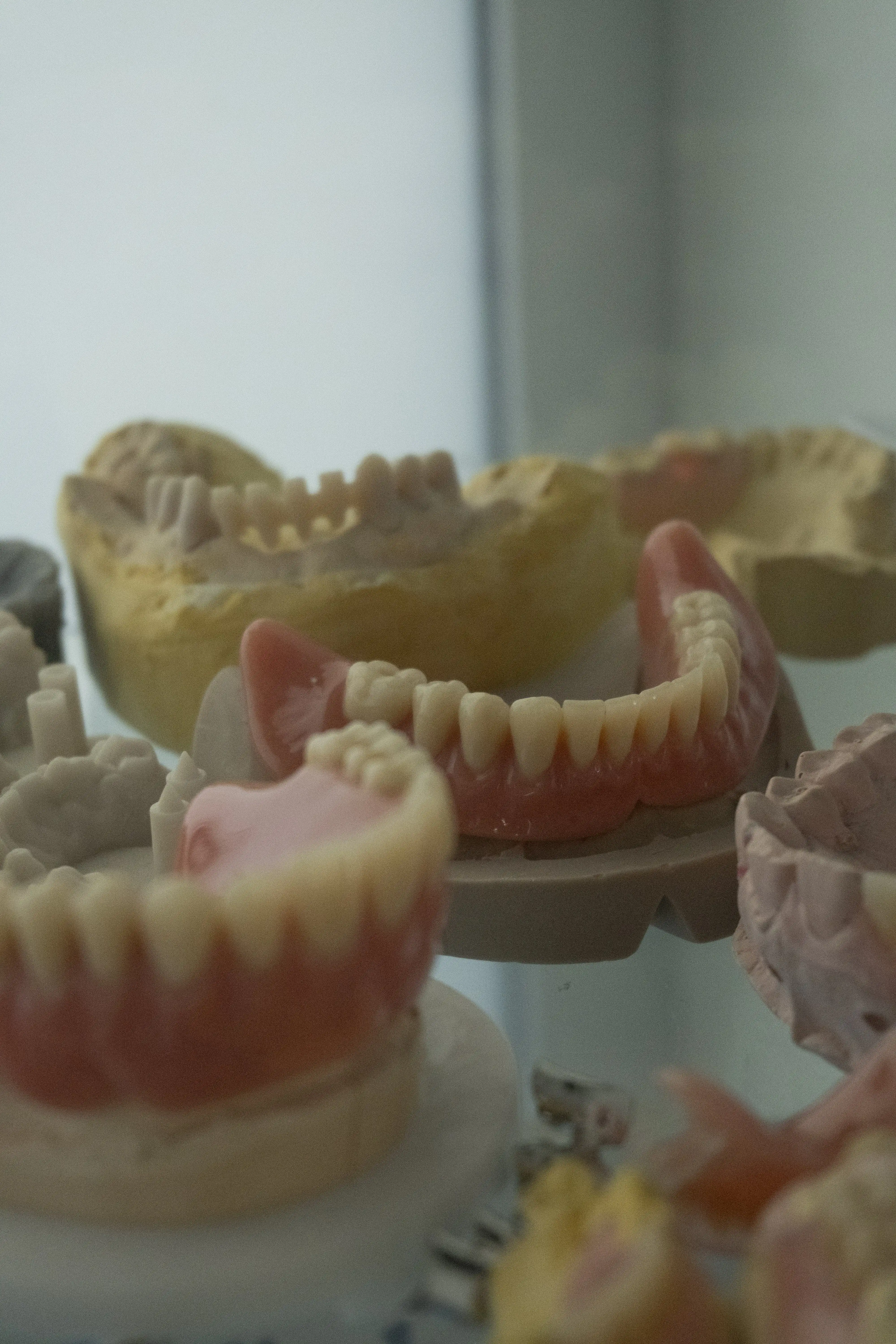 Protesi rimovibili dentarie